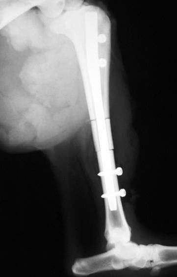 implant